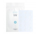 Заживляющие патчи против акне и воспалений Pyunkang Yul Acne Spot Patch Super Thin