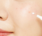 Лечебный локальный крем против акне COSRX AC Collection Ultimate Spot Cream