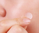 Точечные патчи от воспалений Neogen A-Clear Soothing Clear Spot Patch