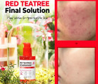 Сыворотка для проблемной кожи Some By Mi Red Tea Tree Cicassoside Final Solution Serum